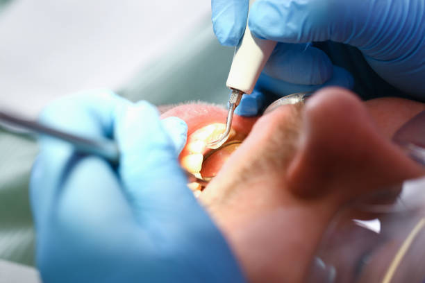 Best Urgent Dental Care for Toothache in Wacousta, MI