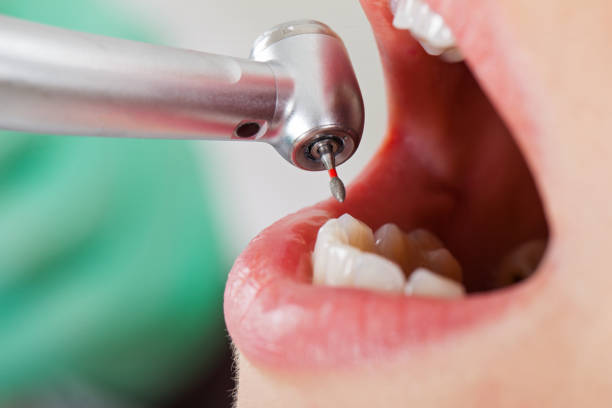 Best Emergency Dental Services for Seniors in Wacousta, MI